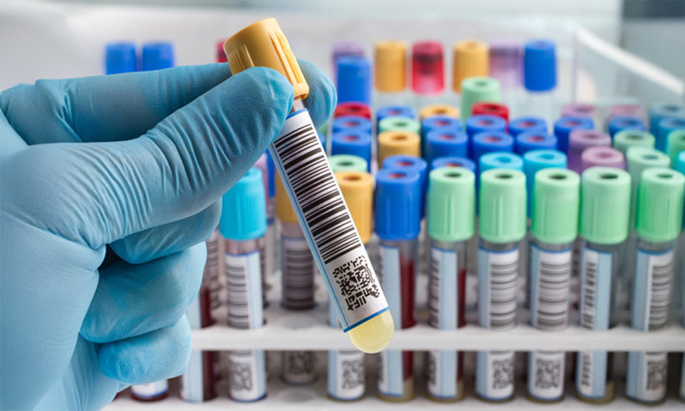 Mujer probando aplicaciones de PSA/RLC para soluciones de atención médica